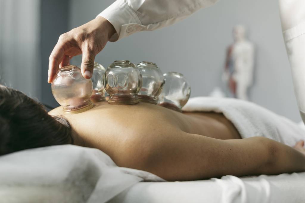 Cupping Therapy for Back Pain