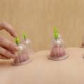 Cupping Therapy: Effective Techniques for Back Pain Relief